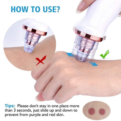 DermaGlow™ Pore Vacuum 6-in-1 Pore Vacuum | Professional Blackhead & Acne Remover