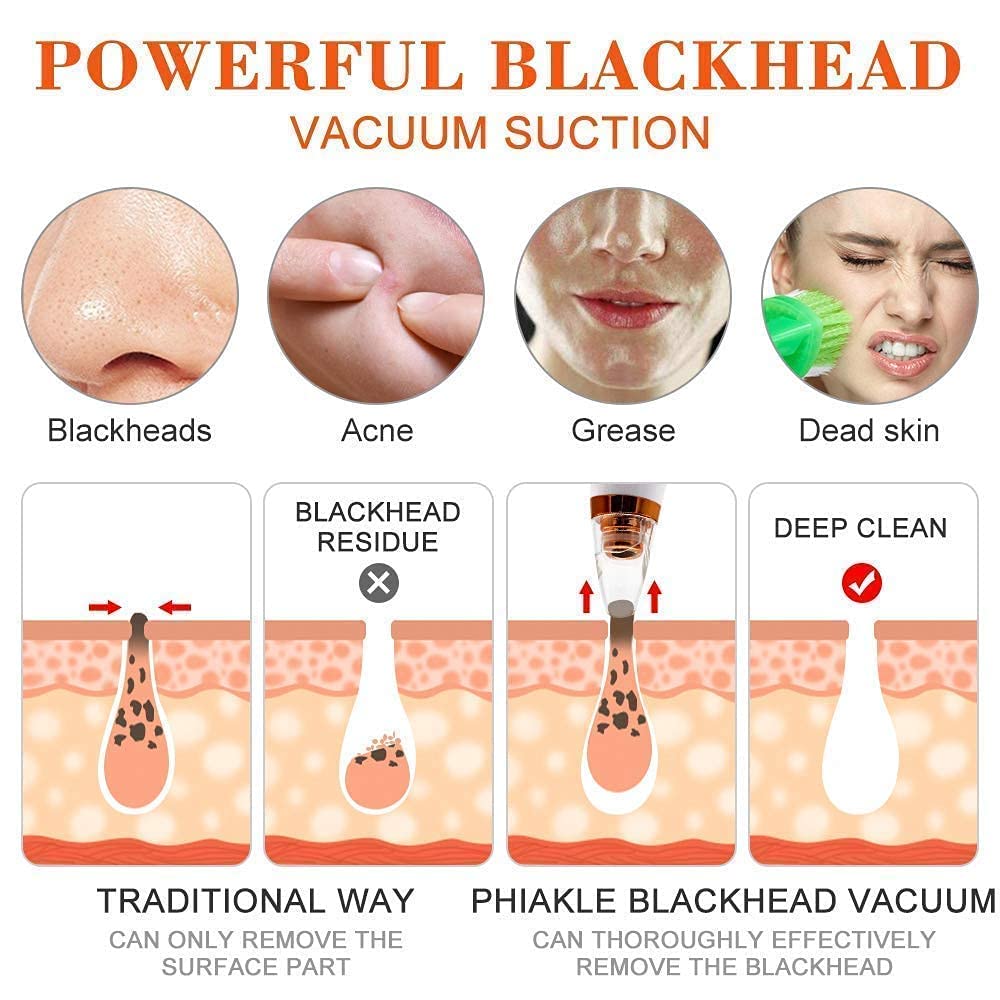 DermaGlow™ Pore Vacuum 6-in-1 Pore Vacuum | Professional Blackhead & Acne Remover
